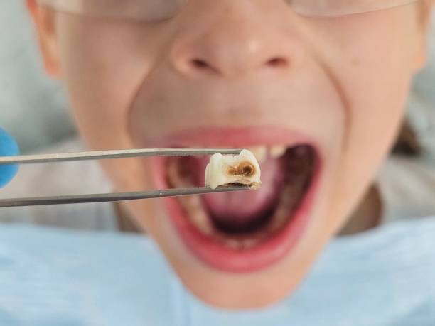 Best Pediatric Emergency Dentist in Wyoming, OH